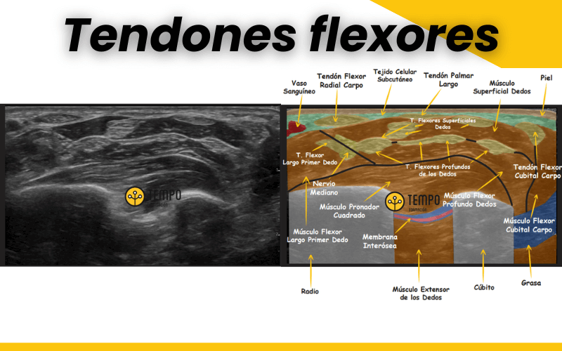 1. Ecografia muñeca anatomia tempo formacion.png